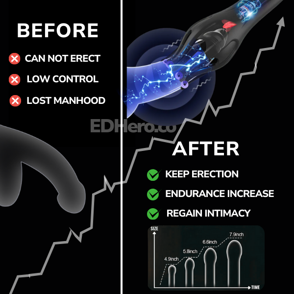 The EDHero™ Shockwave Therapy
