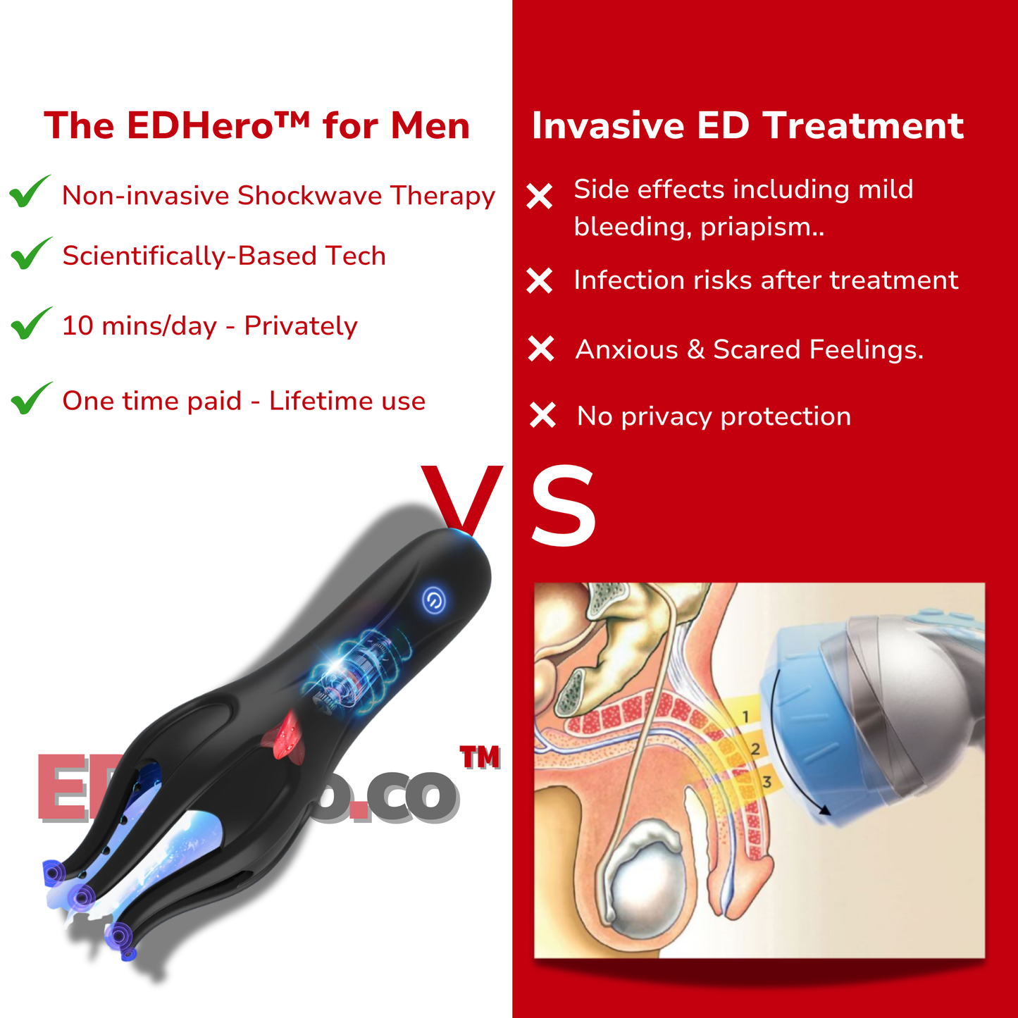 The EDHero™ Shockwave Therapy